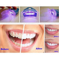 Teeth Whitening Kit - Home Use.